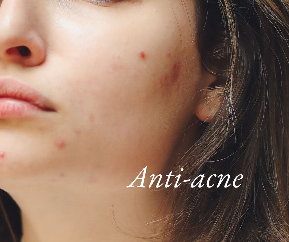 Anti-Acne